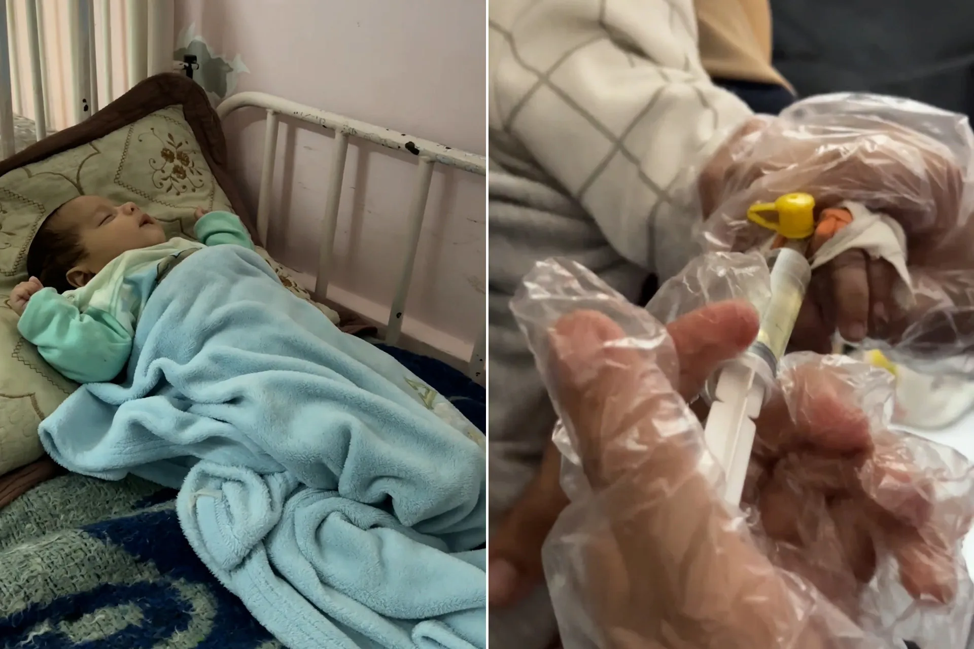 تزايد حالات الحمى الشوكية بين اطفال غزة وسط تحذيرات طبية من كارثة صحية